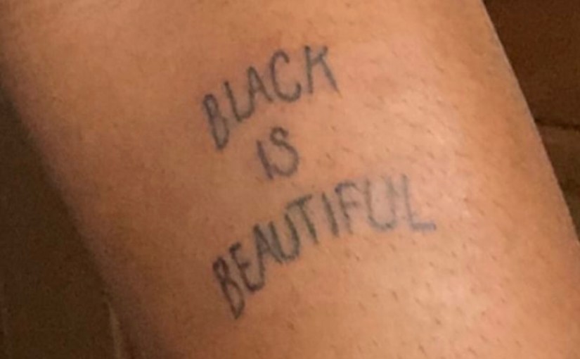 “How does it feel in America?”: Dark&nbsp;Skin